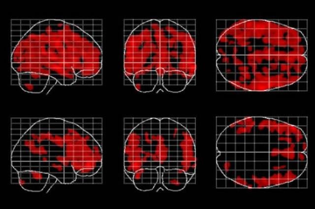meditation-brain O que é meditação e qual a sua relação com a espiritualidade?